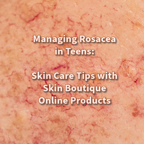 Managing Rosacea in Teens: Skin Care Tips with Skin Boutique Online Products