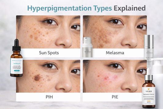 Visual guide showing different types of hyperpigmentation including sun spots, melasma, post-inflammatory hyperpigmentation (PIH), and post-inflammatory erythema (PIE) on facial skin