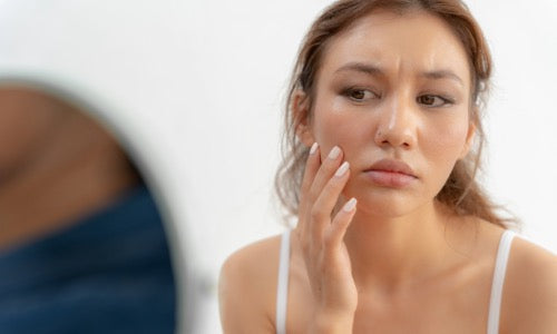 Skin Redness